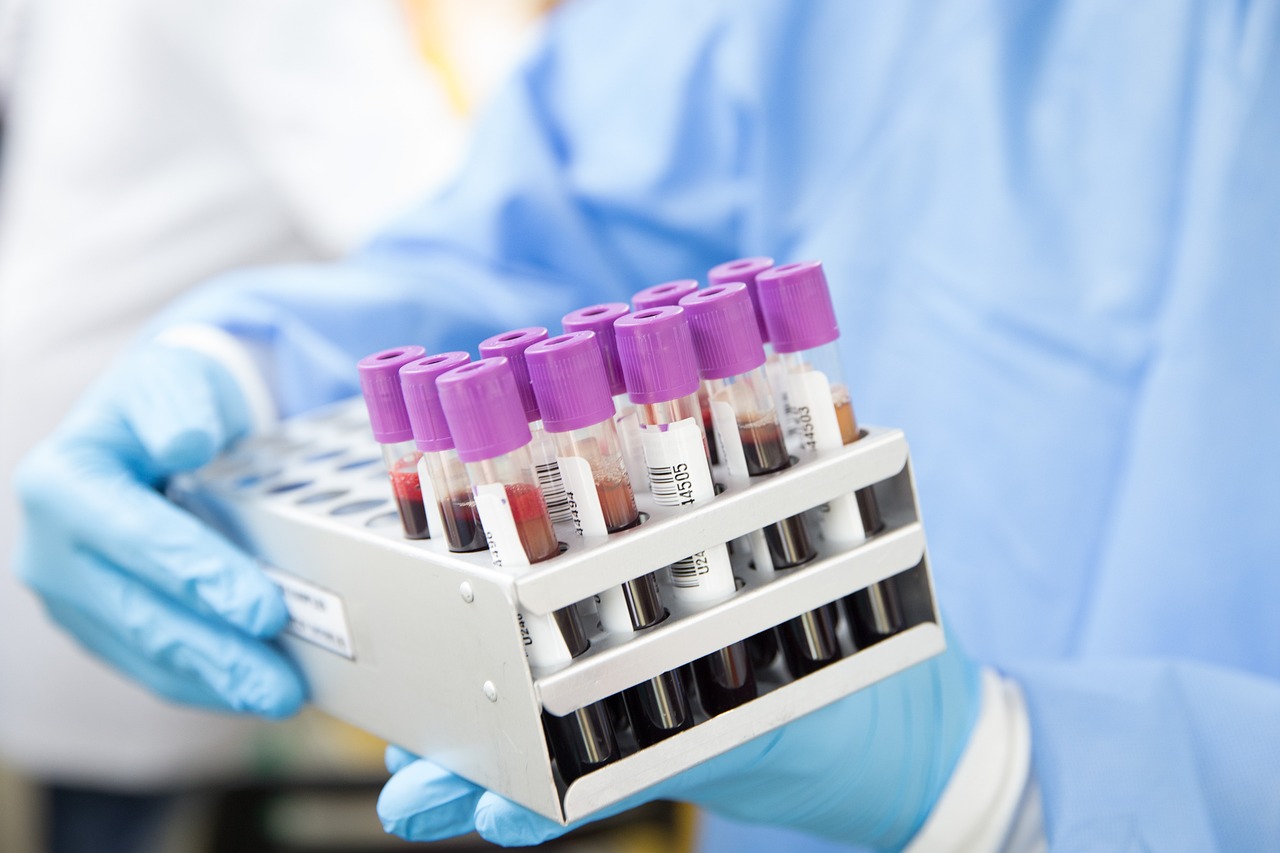 Mains gantées tenant un portoir de tubes de prélèvement sanguin pour analyse médicale